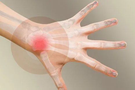 A close up of a person 's hand with a red spot on it.