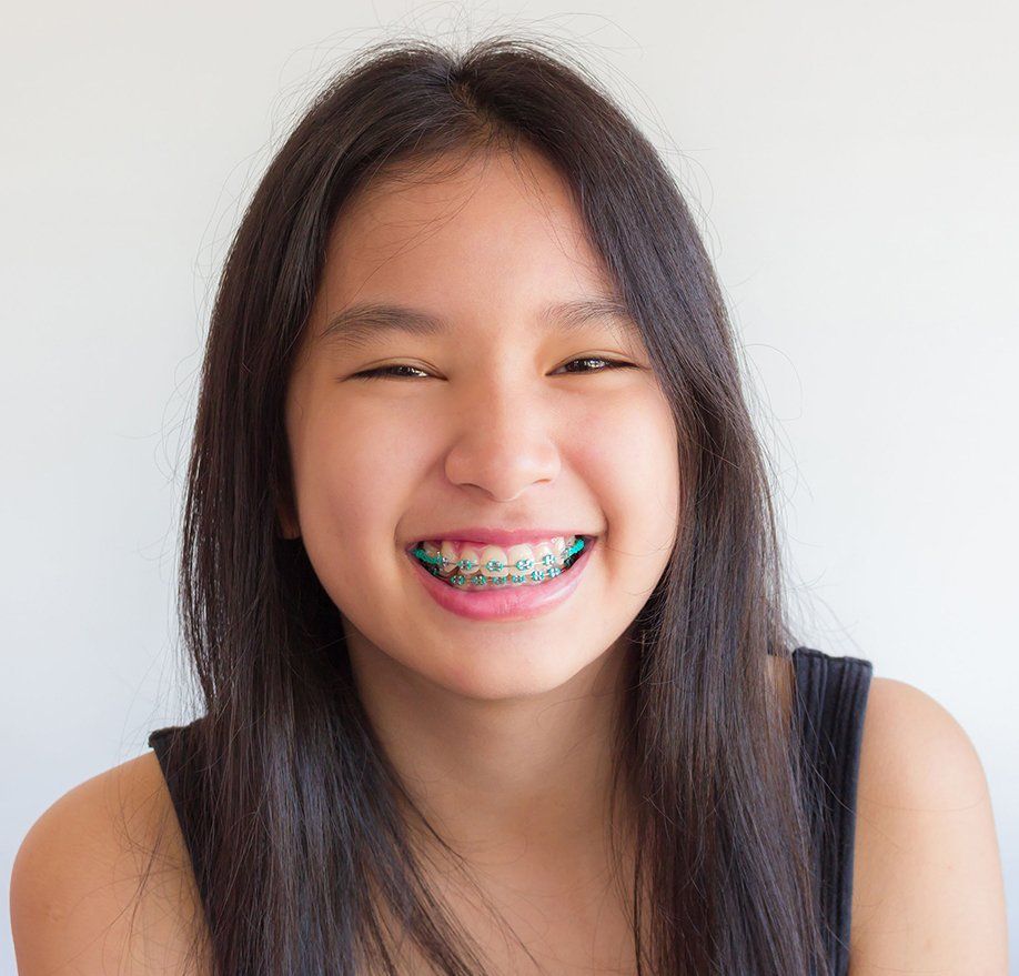 Braces