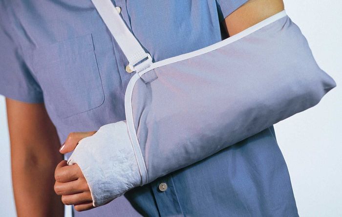 A person with a cast on their arm is wearing a sling