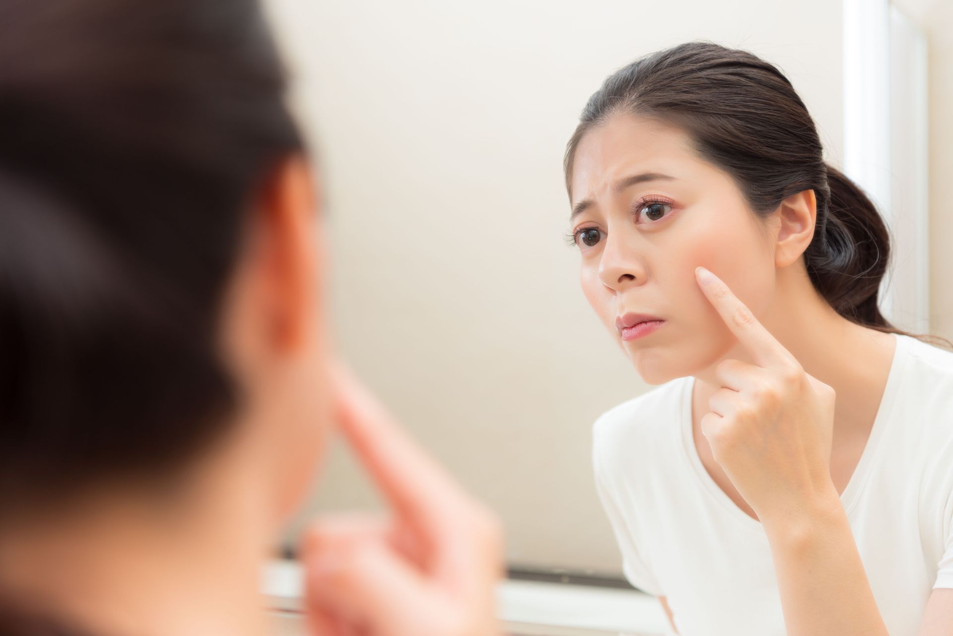 acne treatments