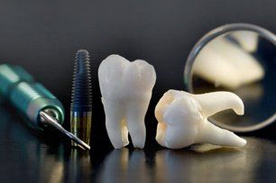 Implants