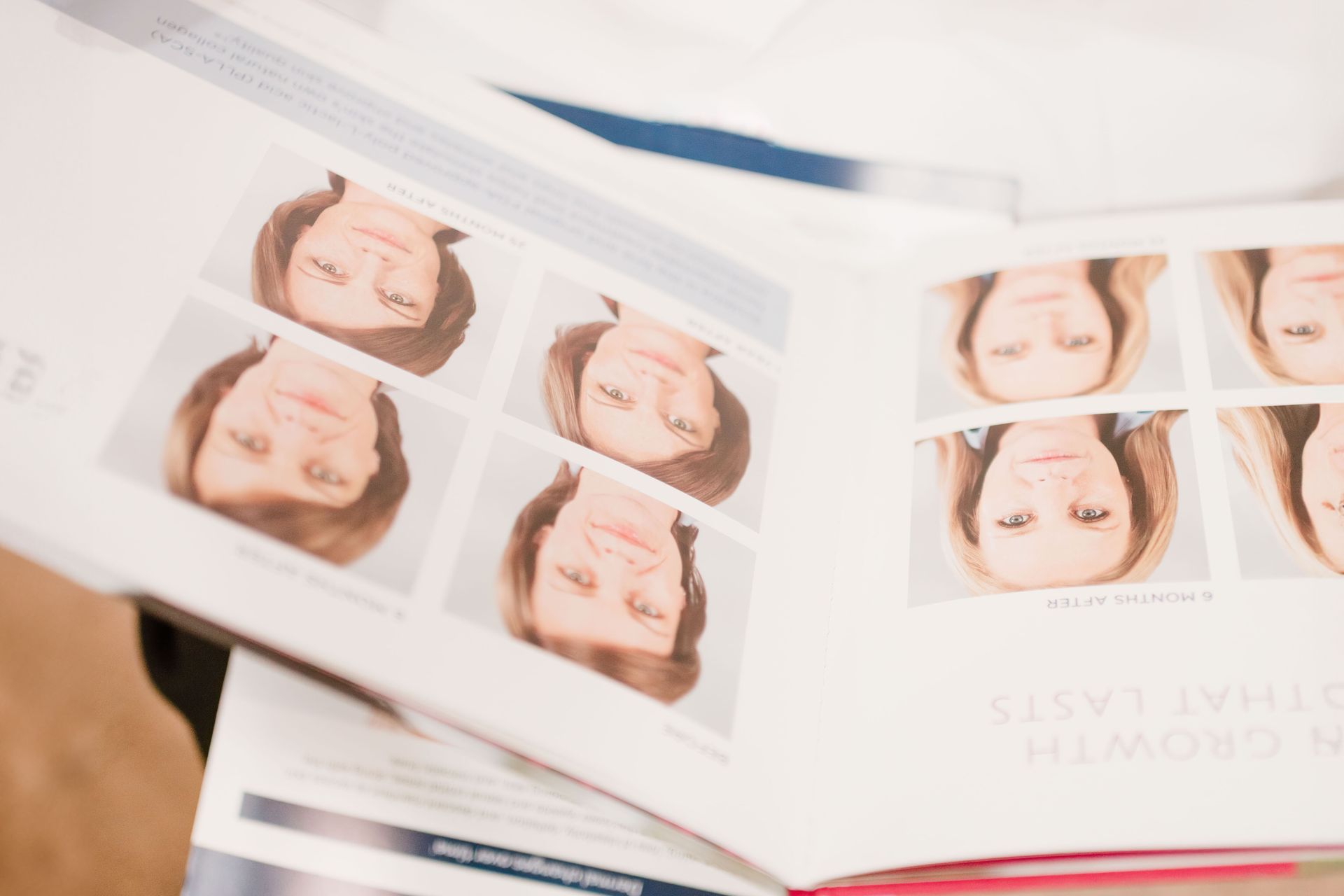 Woman's face with white lines indicating cosmetic surgery points.