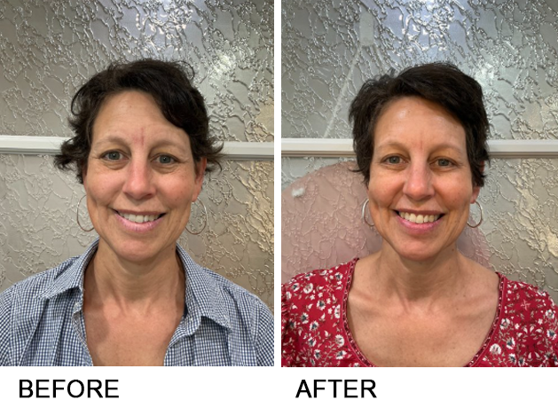 Before and after photos of a woman's face. She smiles, wearing a blue shirt then a red patterned shirt.