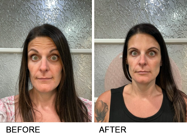 Side-by-side photos showing a woman's face before and after. She has dark hair, surprised expression, and visible wrinkles.