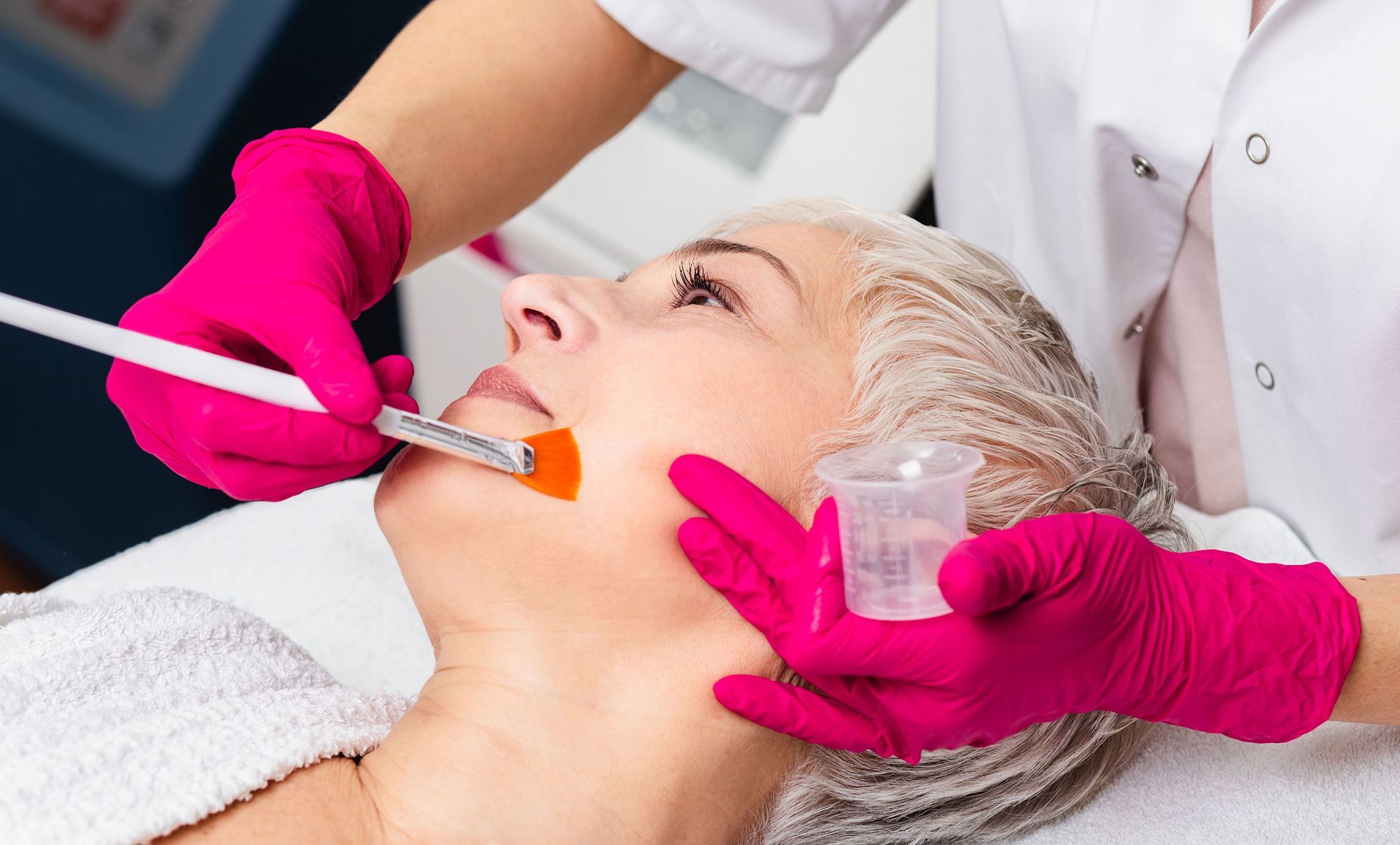 Woman receiving facial peel treatment, clinician applying solution with brush, pink gloves.