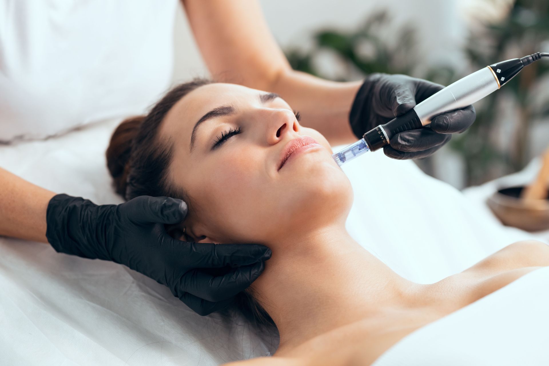 Woman receiving microneedling facial treatment; cosmetician in black gloves using pen-like device on face.