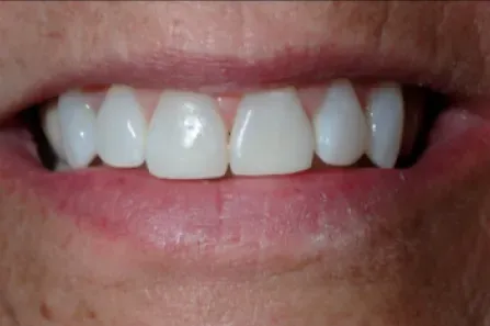 Close-up of a smiling mouth showing white teeth and pink lips.
