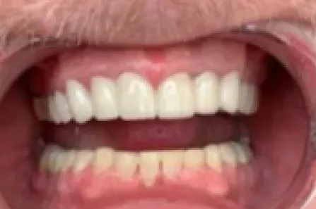 Close-up of a smiling mouth with white teeth and pink lips.