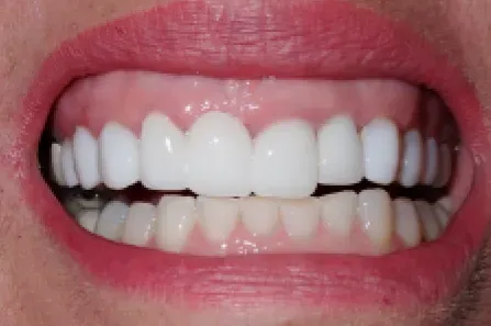Close-up of a smiling mouth with white teeth and pink lips.