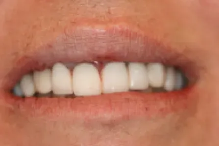 Close-up of a smiling mouth with white teeth and pink lips.