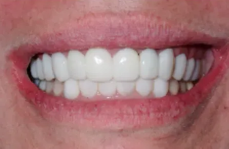 Close-up of a smiling mouth showing white teeth and pink lips.