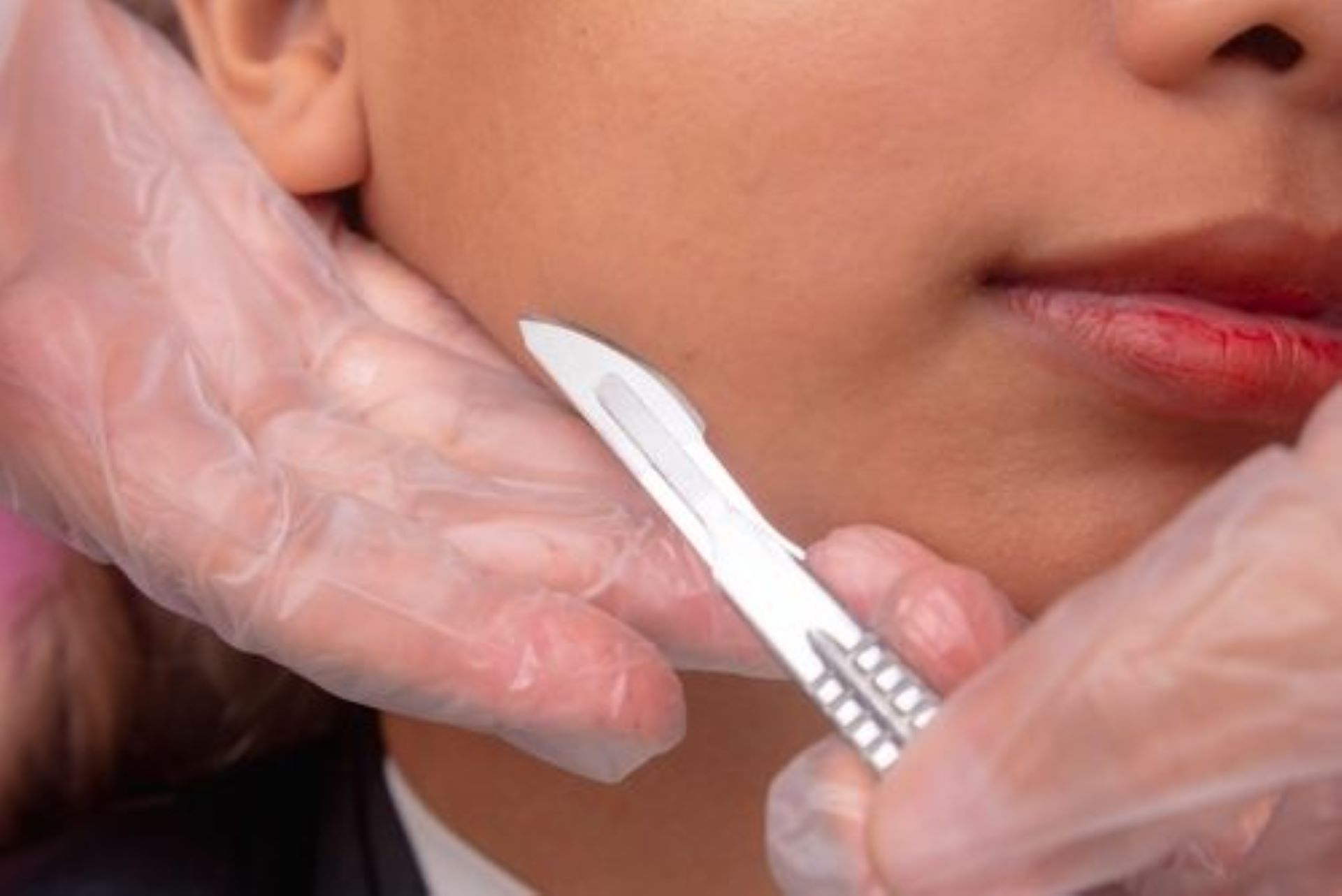 Person's face being held while a gloved hand positions a scalpel near their cheek, preparing for a medical procedure.