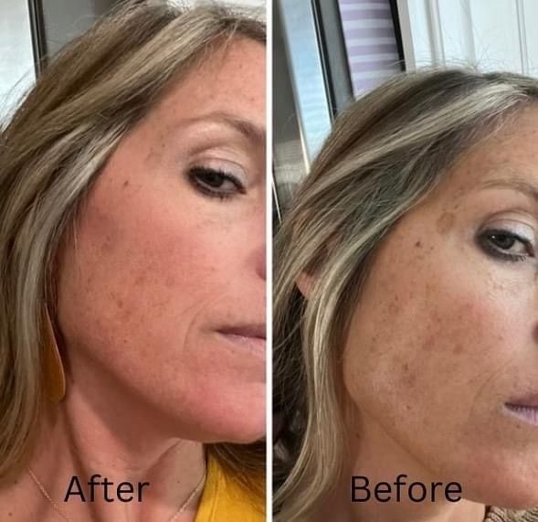 Side-by-side comparison of a woman's face: 