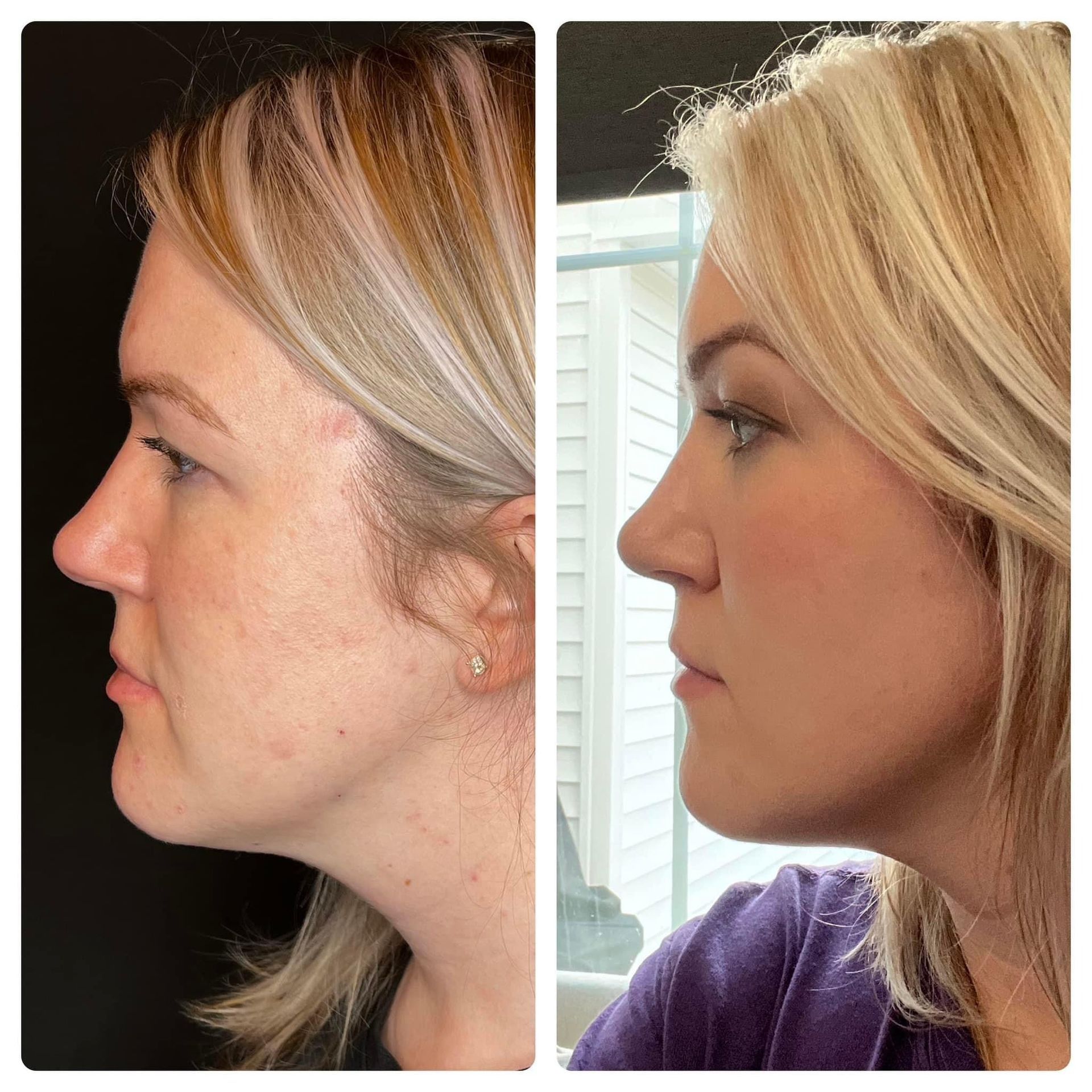 Before-and-after profile photos of a woman. The 