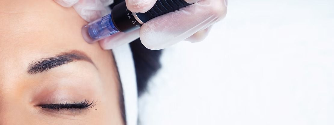 A gloved hand uses a syringe on a woman's eyebrow area during a cosmetic procedure.