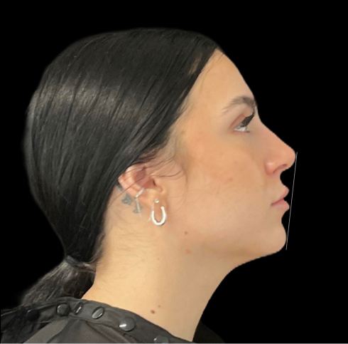 Profile view of a woman with dark hair in a low bun, wearing silver earrings against a black background