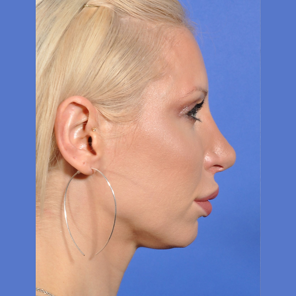 Profile view of a blonde woman against a blue background, wearing a large hoop earring.