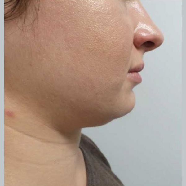Side profile of a person’s face and neck against a plain gray background