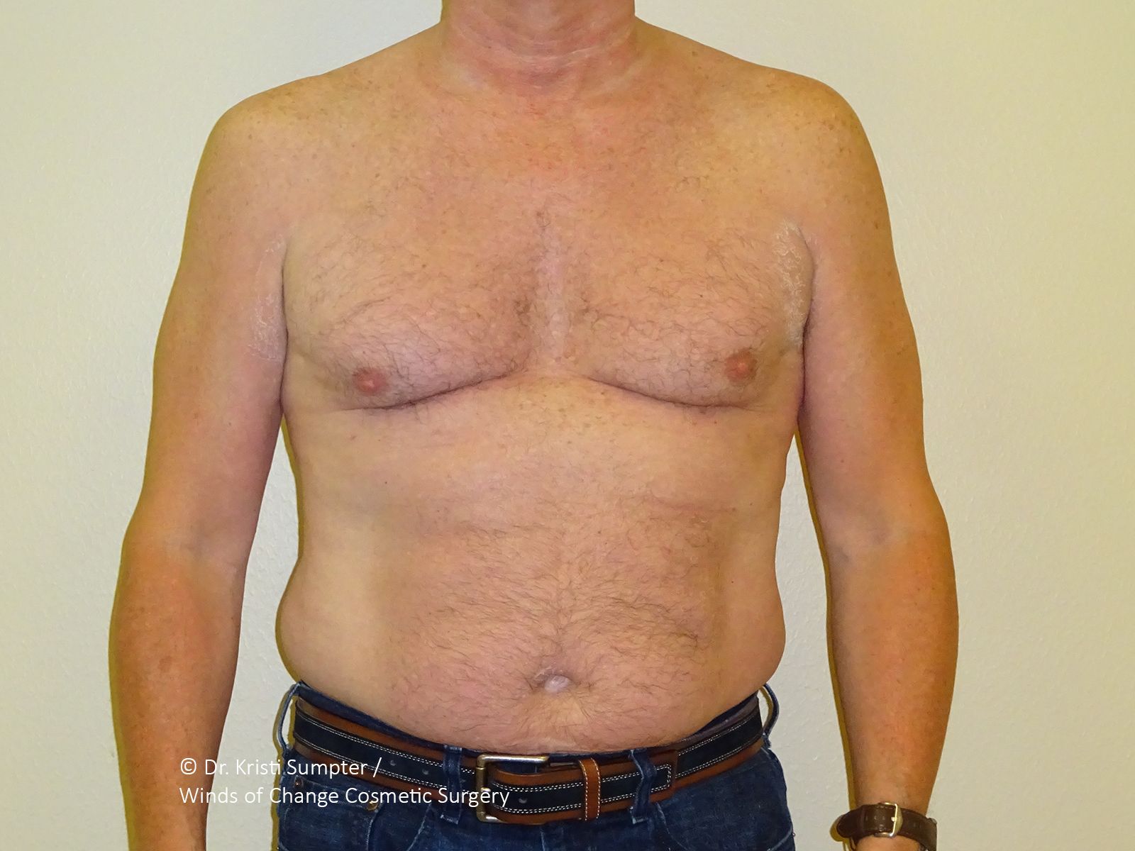 A front view of a person’s bare chest and torso wearing blue jeans with a brown belt against a light background.