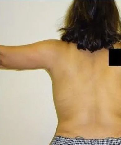 Person from the back with one arm outstretched. The back is tan-colored. Short dark hair.