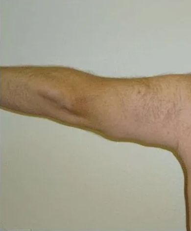 Arm bent at the elbow, tan skin, with some body hair, and a plain background.