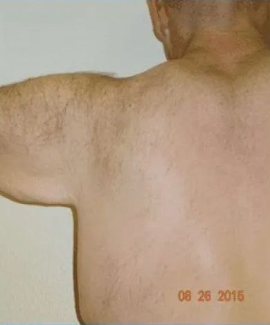 Person's back and shoulder, turned away from the camera. The arm is slightly raised.