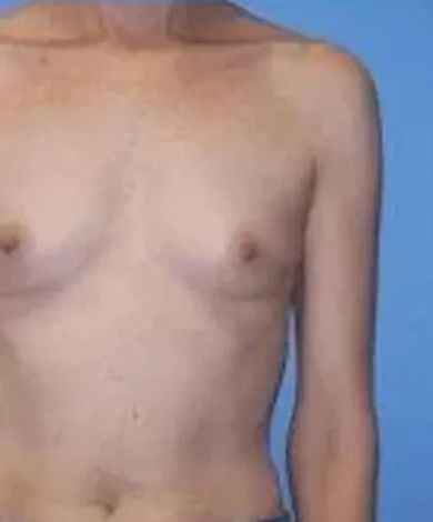 Bare torso, showing chest and arm, against a blue background.