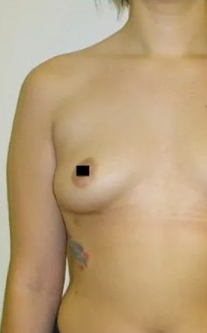 Torso of a person, facing forward. Light skin, exposed chest. A tattoo is visible on the arm.