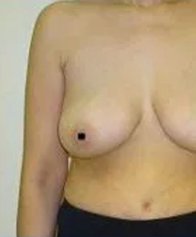 Torso of a person with breasts, showing the upper abdomen.