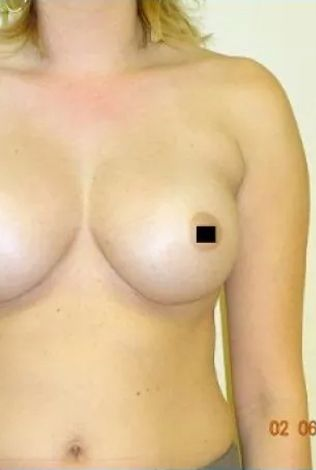 Woman's upper body with one nipple censored. Skin tone is light. Date in lower right corner.