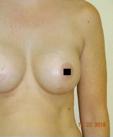 Torso with breasts, nipple obscured. Arm to the right. Date stamp on lower right corner.