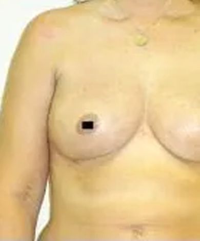 Torso with a visible breast, nipple obscured by a black square. Skin is light-toned.