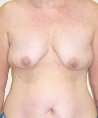 Torso, breasts slightly sag, areola pink, skin toned.