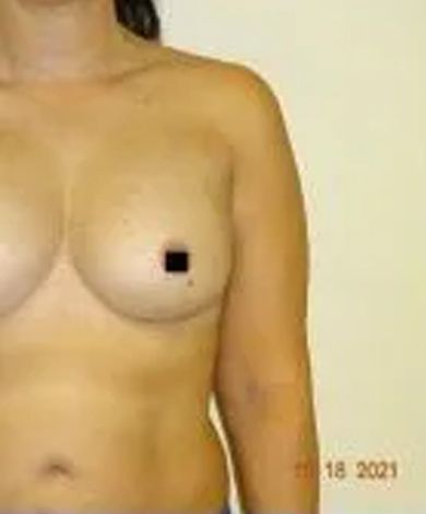 Upper body of a person with bare chest; black square covers one nipple.