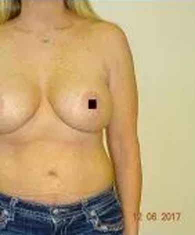 Woman's torso wearing blue jeans, bare-chested. A small black square covers the right nipple.