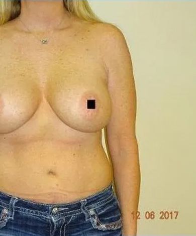 Woman in jeans, upper body visible, against a light wall, date stamp in the corner, with a black square obscuring the nipple.