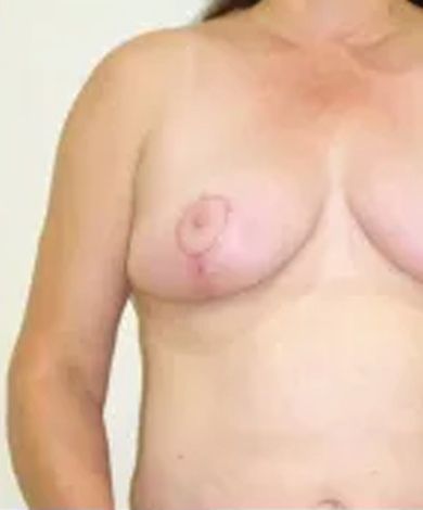 A person's torso, featuring two breasts with visible nipples, and a tan skin tone.