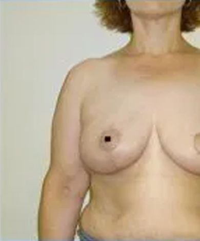Woman's torso, frontal view, nude. Brown skin, breasts visible. Beige background.