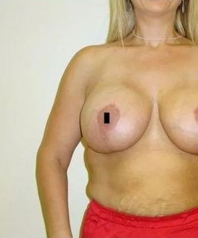 Woman's bare chest with dark square covering the left nipple, wearing red shorts and a necklace.