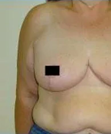 Person's torso with a black box covering the nipple area. Brown skin tone.