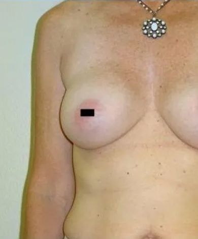 Upper torso of a person with a necklace. One nipple is visible with a black censor.