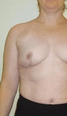 Nude torso; one breast visible with nipple. Black waistband. Against plain, light wall.