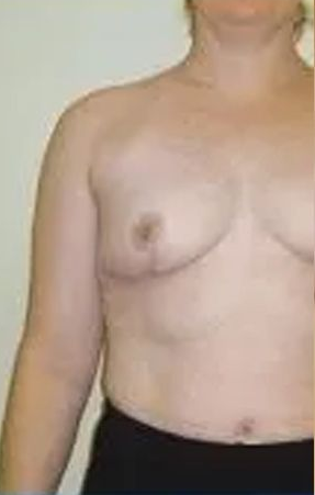 Torso of a person, facing forward. Light skin, bare chest, black shorts, beige background.