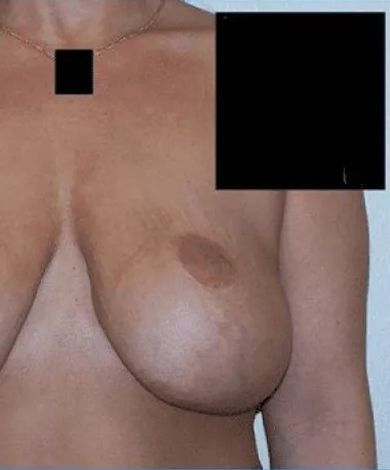 Naked torso, with a brown areola and breast, and a gold necklace. Part of the image is obscured with black rectangles.