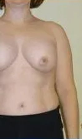 Torso of a person with bare breasts, wearing a black skirt. The background is a plain wall.