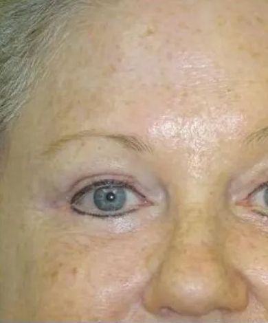 Close-up of a person's face; visible eye with eyeliner, freckled skin, eyebrow.