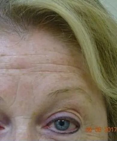 Close-up of a person's eye and forehead with wrinkles and blonde hair. Blue eye with dark eyeliner.