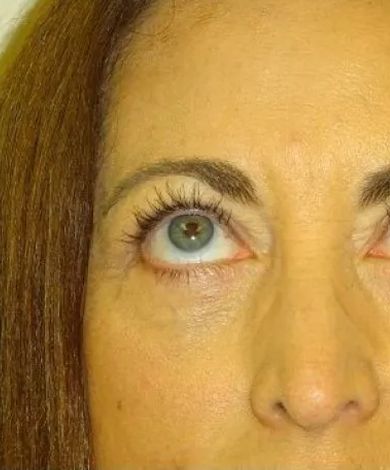 Close-up of a person's face looking up. Light skin, blue eye, brown eyebrows, and nose.