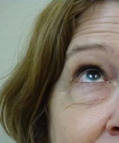 Close-up of a person's eye looking up; blue iris, wrinkles, and light brown hair.