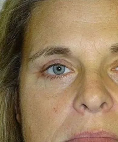 Close-up of a person's face; blue eye, light skin, and small wrinkles around the eye.